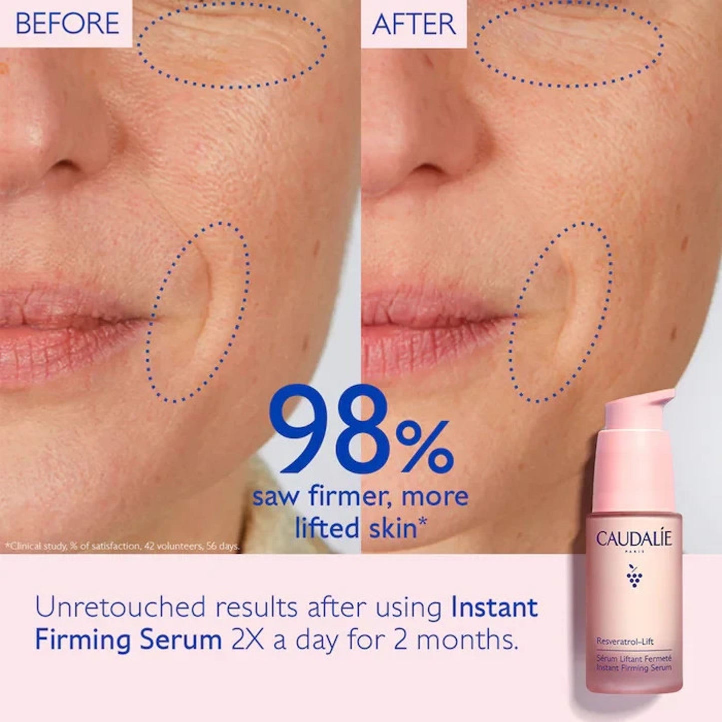CAUDALIE Resveratrol Lift Instant Firming Serum 30ml 1fl oz, MSRP: 85$